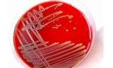 美国ATCC 震颤纤维单胞菌